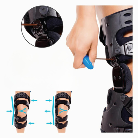Ameliorarea osteoartritei genunchiului - Confort articular și stabilitate maximă